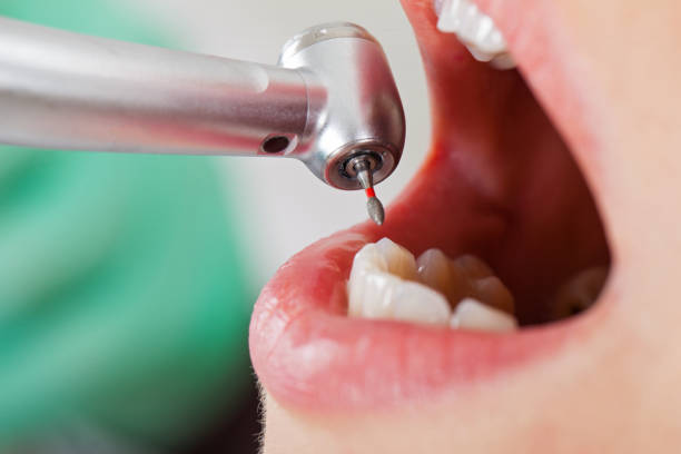 Best Emergency Treatment for Toothache in Moultrie, GA